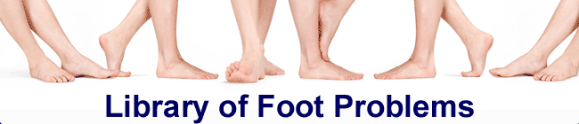 Library of Foot Problems