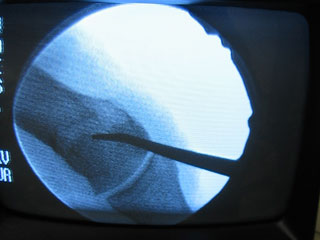 Video Xray